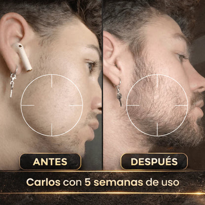 Balsamo para crecimiento de barba ultra potente con minoxidil 20% | 100 ml