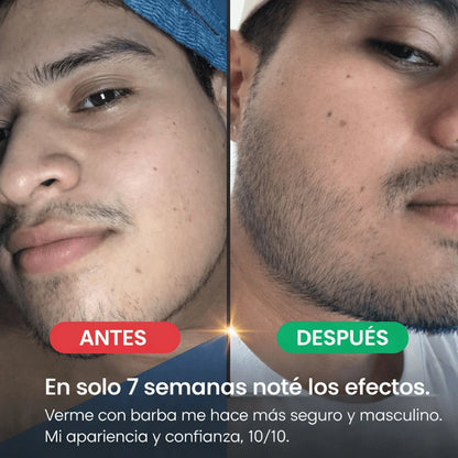 Balsamo para crecimiento de barba ultra potente con minoxidil 20% | 100 ml