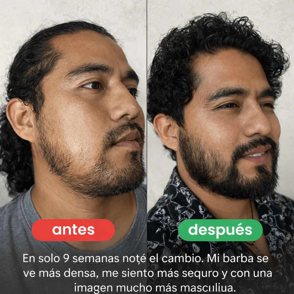 Balsamo para crecimiento de barba ultra potente con minoxidil 20% | 100 ml