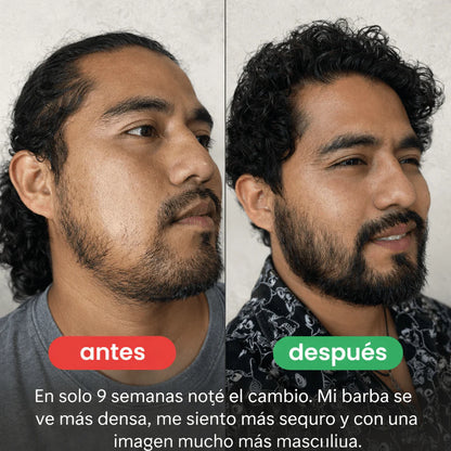 Balsamo para crecimiento de barba ultra potente con minoxidil 20% | 100 ml